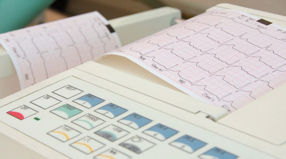 Langzeit-EKG: Was es misst – und wie es Training besser einordnen kann